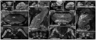 Comparison of Navigation-Related Brain Regions in Migratory versus Non-Migratory Noctuid Moths